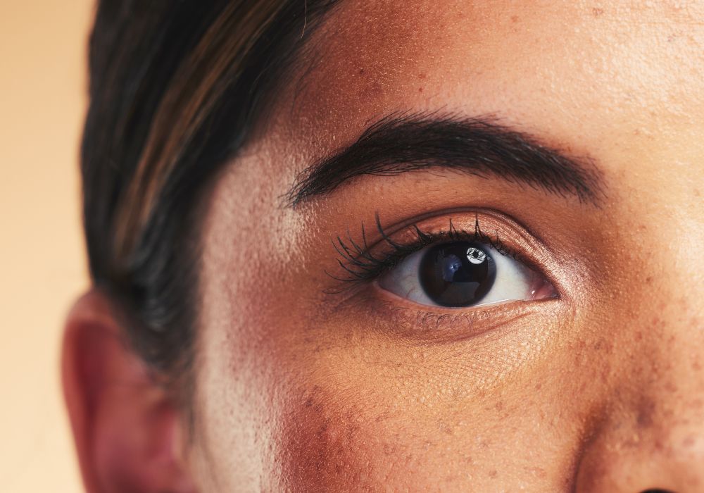 Acide Tranexamique en Cosmétique : Traiter l'Hyperpigmentation