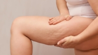 Thérapie par Ondes Acoustiques (AWT) pour Traiter la Cellulite et la Texture de la Peau