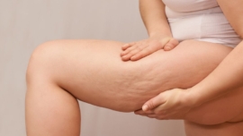 Thérapie par Ondes Acoustiques (AWT) pour Traiter la Cellulite et la Texture de la Peau