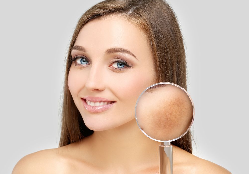 Acido Tranexamico in Cosmetica Trattare l'Iperpigmentazione