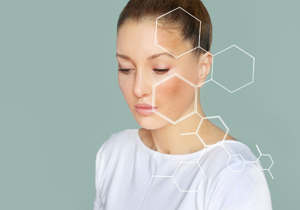 Como Usar o Óleo de Rosa Mosqueta Para Clarear Manchas 