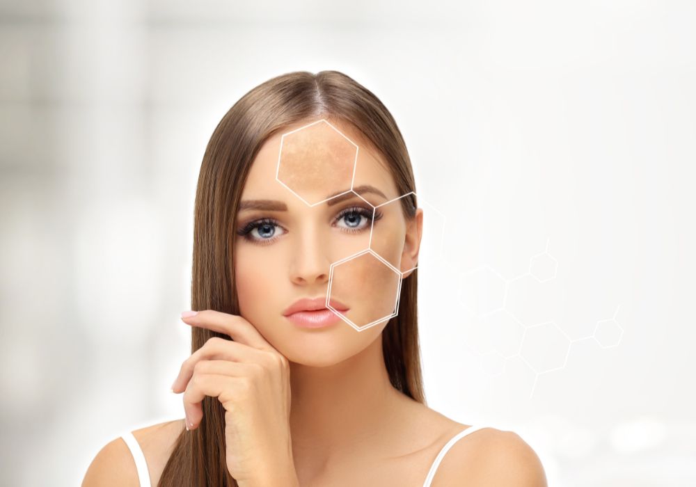 Formas de Uso do Ácido Tranexâmico para Manchas