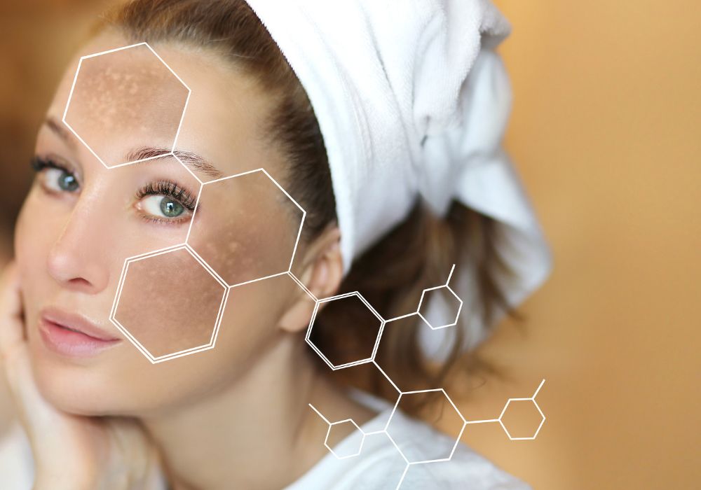 O que é o Ácido Tranexâmico e como ele Clareia Manchas