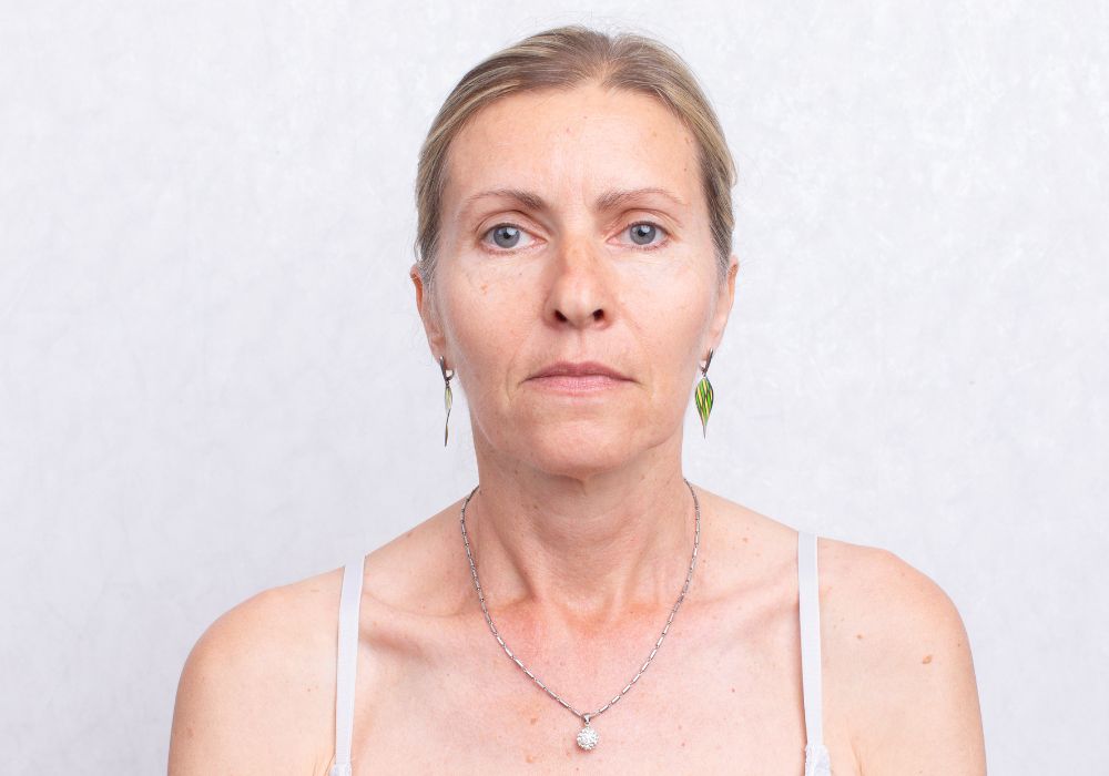 Os Melhores Dermocosméticos para Flacidez Facial (2025)