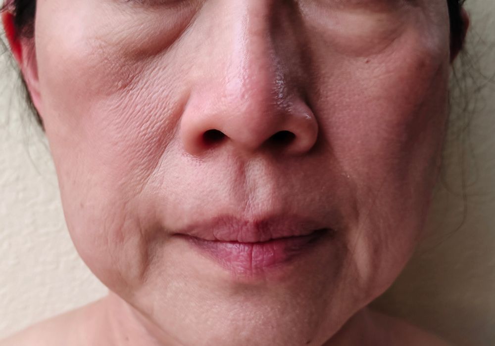 Qual o Melhor Dermocosmético para Flacidez Facial