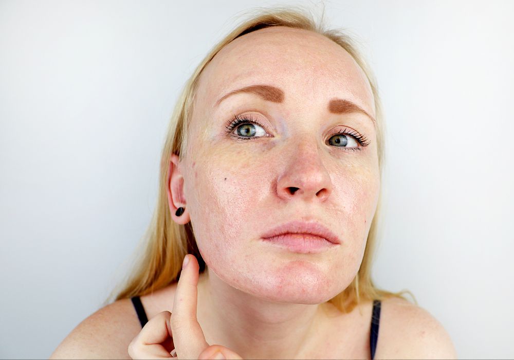 Rotina de Skincare para Quem Tem Pele Oleosa - Pele Saudável e Equilibrada