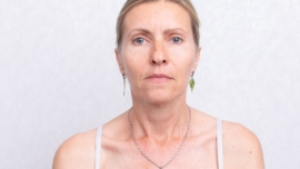 Top 5 Dermocosméticos para Flacidez Facial Após os 40 Anos