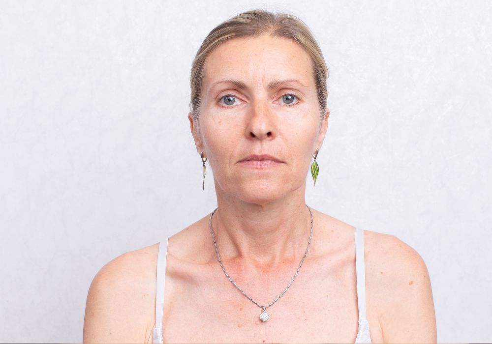 Top 5 Dermocosméticos para Flacidez Facial Após os 40 Anos