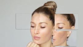 Sérum de Vitamina C Famoso por suas propriedades antioxidantes e clareadoras