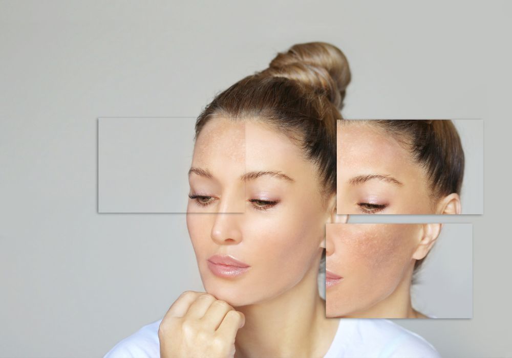 Sérum de Vitamina C Famoso por suas propriedades antioxidantes e clareadoras