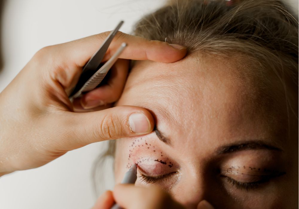 Cirurgia de Blefaroplastia Quanto Custa e Vale a Pena Fazer