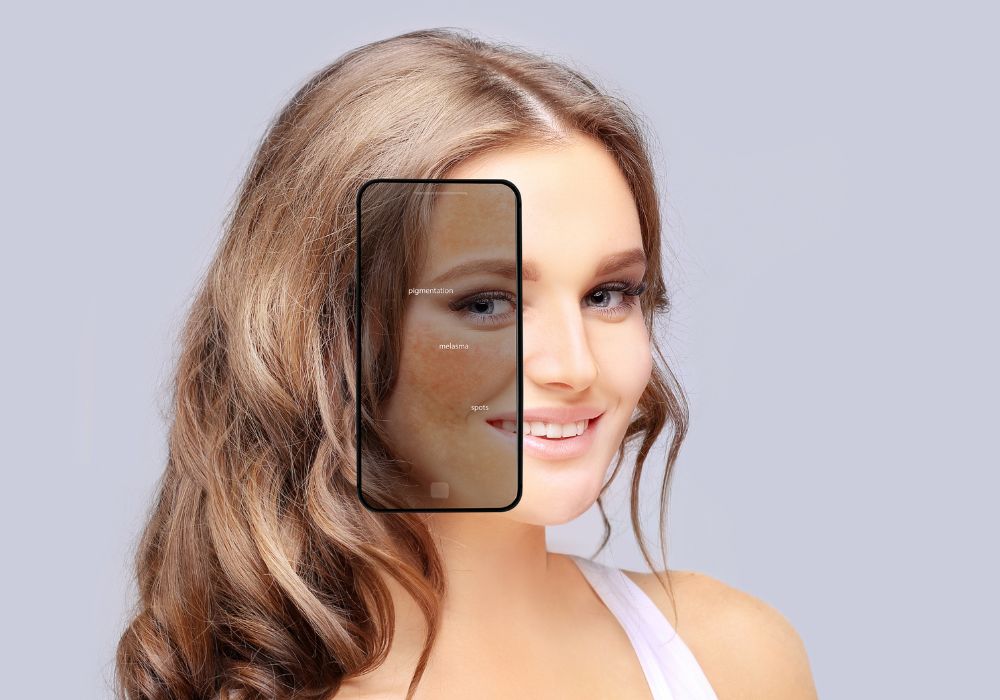 Melhores Produtos para Clarear Melasma