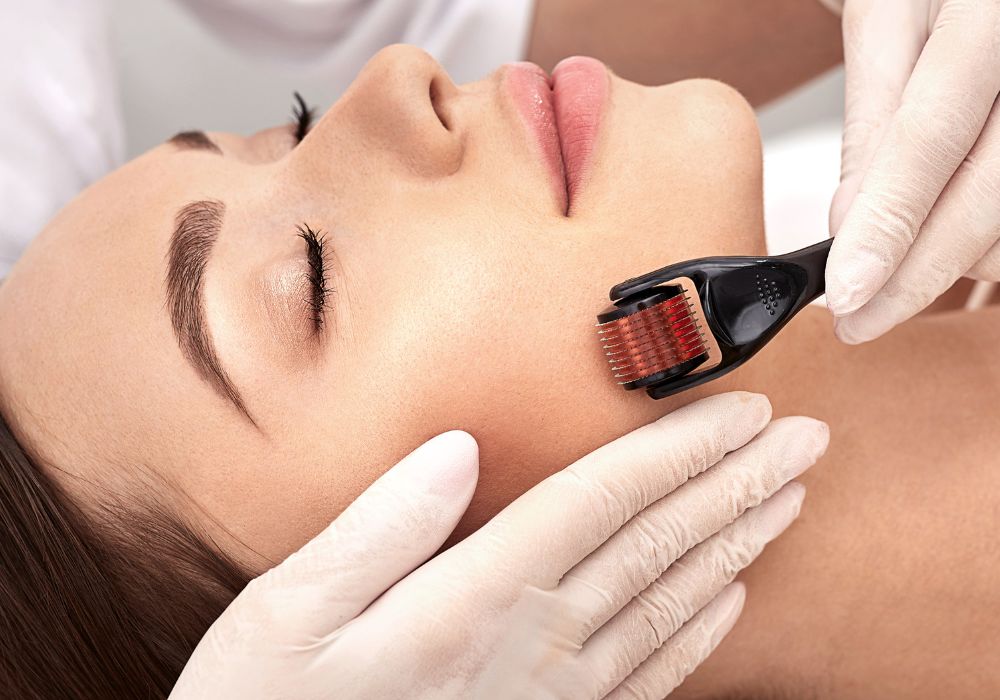 Cuidados antes e depois do microagulhamento