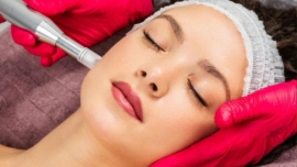 Microagulhamento o que é, para que serve e como é feito