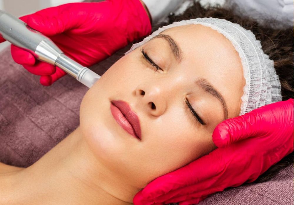 Microagulhamento o que é, para que serve e como é feito